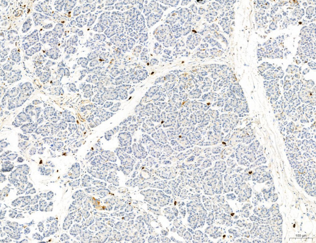 Phospho-PKM2 (Ser37) Antibody in Immunohistochemistry (Paraffin) (IHC (P))