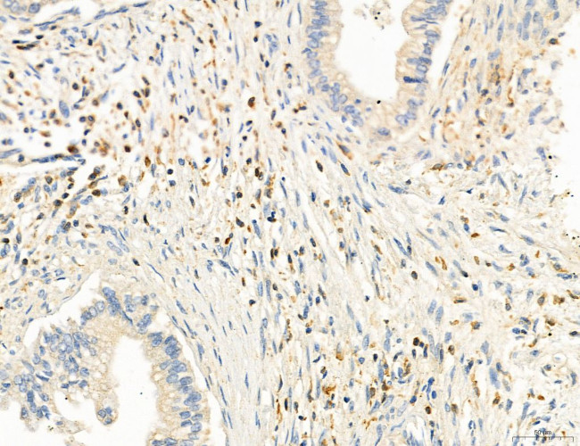 Phospho-PKM2 (Ser37) Antibody in Immunohistochemistry (Paraffin) (IHC (P))