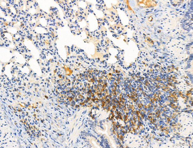 Phospho-PKM2 (Ser37) Antibody in Immunohistochemistry (Paraffin) (IHC (P))