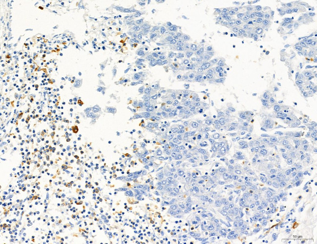 Phospho-PKM2 (Ser37) Antibody in Immunohistochemistry (Paraffin) (IHC (P))