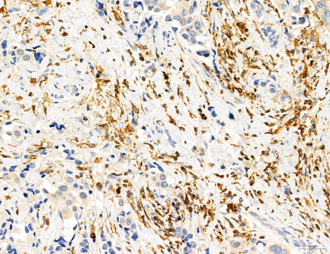 Phospho-PKM2 (Ser37) Antibody in Immunohistochemistry (Paraffin) (IHC (P))