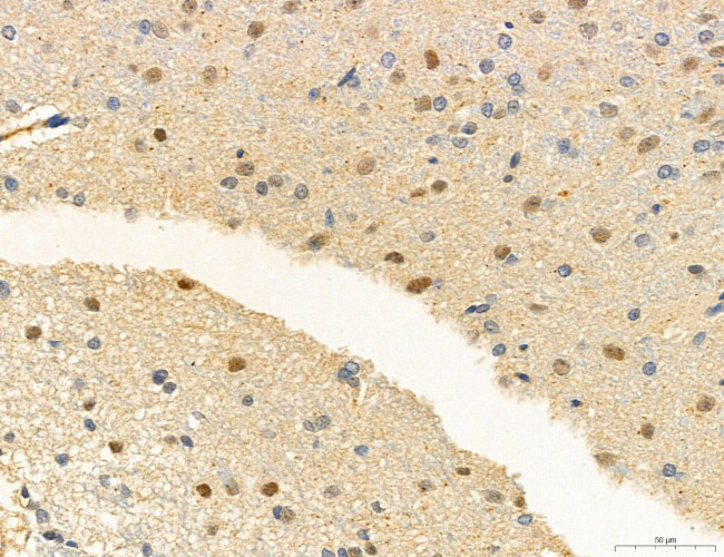 Phospho-PKM2 (Ser37) Antibody in Immunohistochemistry (Paraffin) (IHC (P))