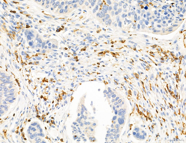 Phospho-PKM2 (Ser37) Antibody in Immunohistochemistry (Paraffin) (IHC (P))