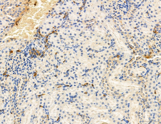 Phospho-PKM2 (Ser37) Antibody in Immunohistochemistry (Paraffin) (IHC (P))