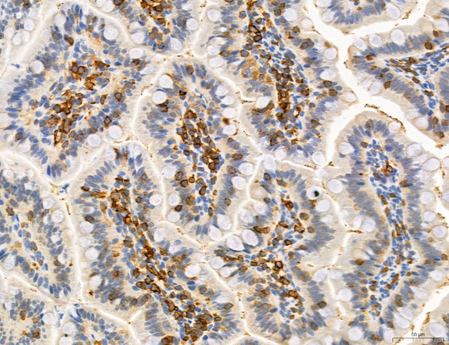 Phospho-PKM2 (Ser37) Antibody in Immunohistochemistry (Paraffin) (IHC (P))