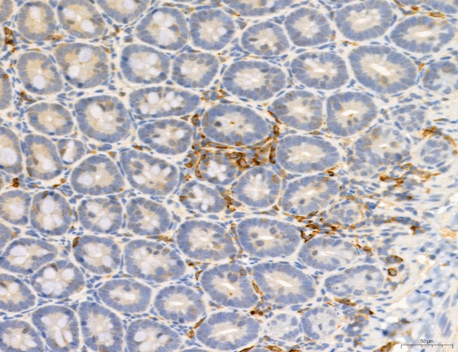 Phospho-PKM2 (Ser37) Antibody in Immunohistochemistry (Paraffin) (IHC (P))