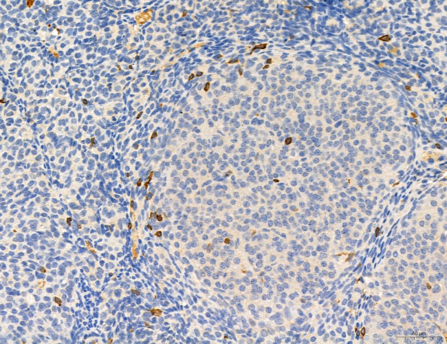 Phospho-PKM2 (Ser37) Antibody in Immunohistochemistry (Paraffin) (IHC (P))