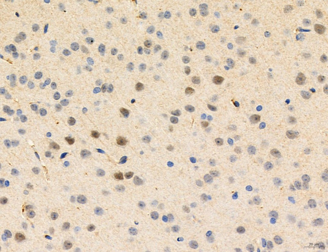 Phospho-PKM2 (Ser37) Antibody in Immunohistochemistry (Paraffin) (IHC (P))