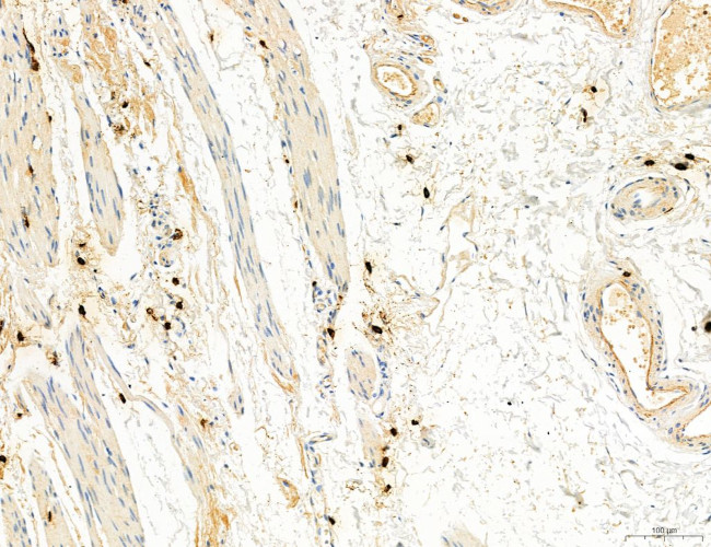 Phospho-PKM2 (Ser37) Antibody in Immunohistochemistry (Paraffin) (IHC (P))