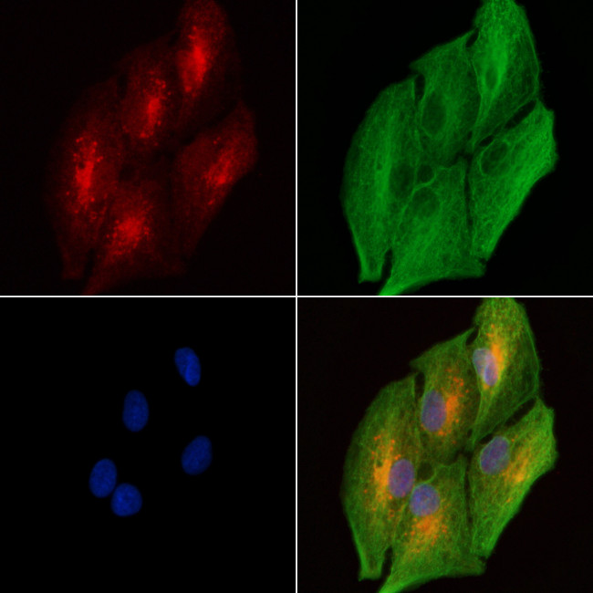 DAB2 Antibody in Immunocytochemistry (ICC/IF)