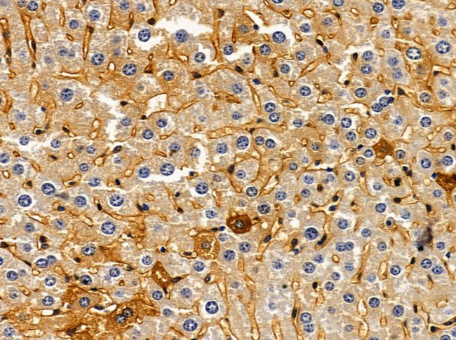 DAB2 Antibody in Immunohistochemistry (Paraffin) (IHC (P))