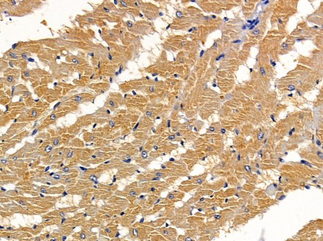 DAB2 Antibody in Immunohistochemistry (Paraffin) (IHC (P))