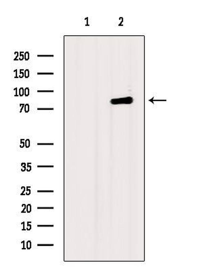 DAB2 Antibody in Western Blot (WB)