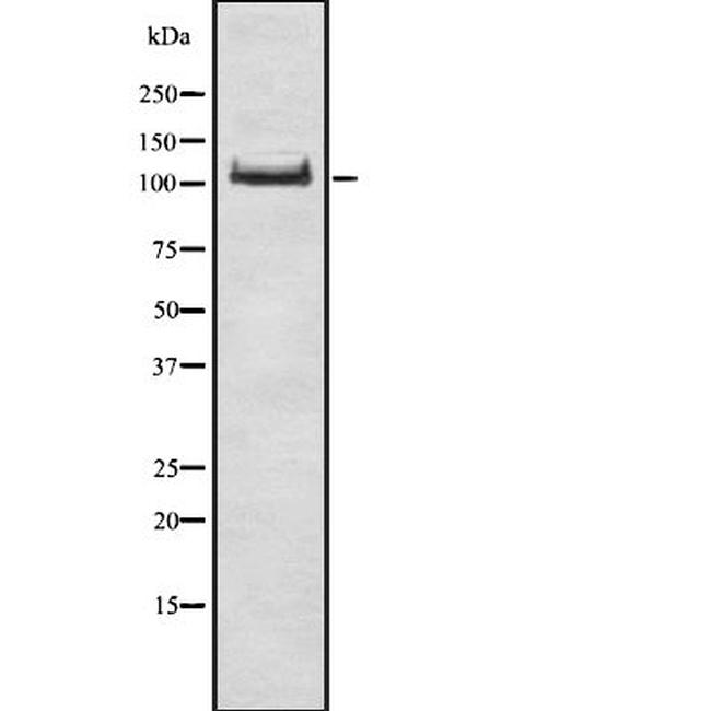 ADAP Antibody in Western Blot (WB)