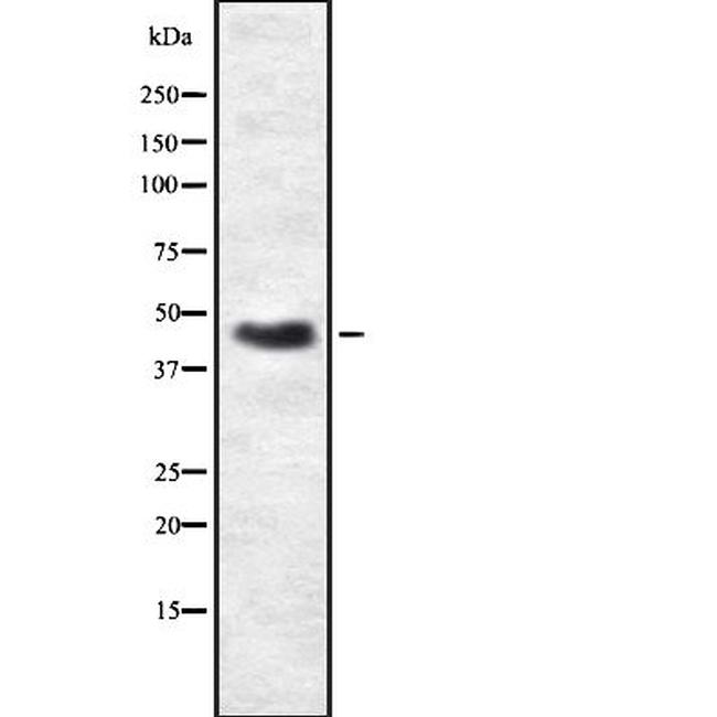 PRKAR2B Antibody in Western Blot (WB)