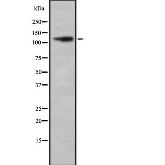 REST Antibody in Western Blot (WB)