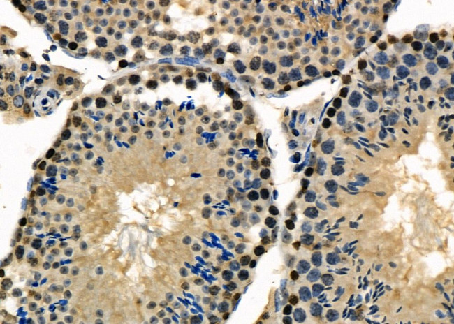 PABPN1 Antibody in Immunohistochemistry (Paraffin) (IHC (P))