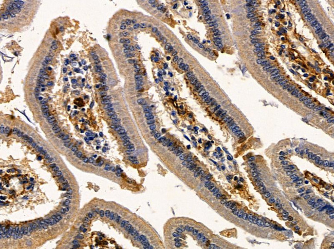 C1QA Antibody in Immunohistochemistry (Paraffin) (IHC (P))