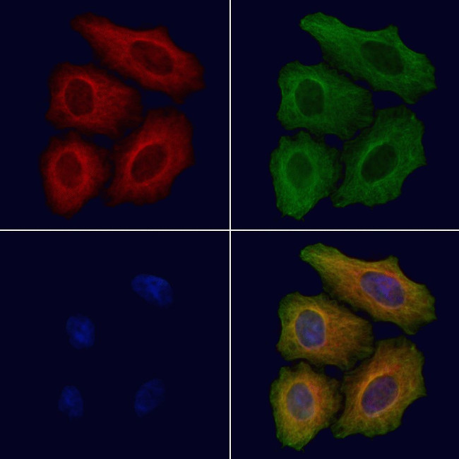 C1QA Antibody in Immunocytochemistry (ICC/IF)