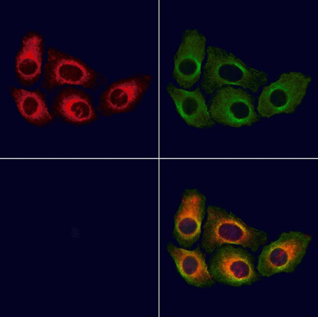 PSMA Antibody in Immunocytochemistry (ICC/IF)