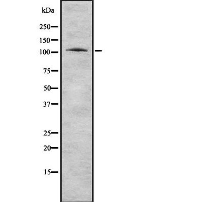 PSMA Antibody in Western Blot (WB)