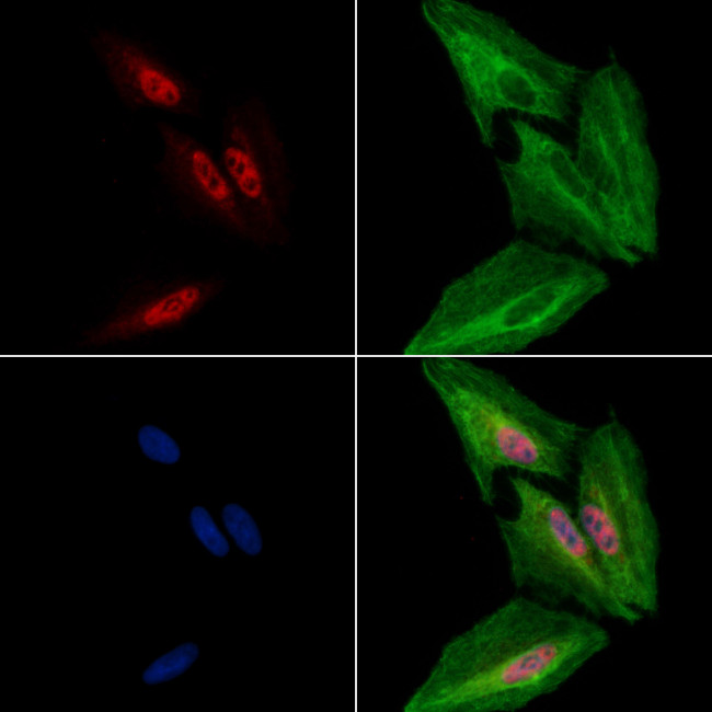 HB9 Antibody in Immunocytochemistry (ICC/IF)