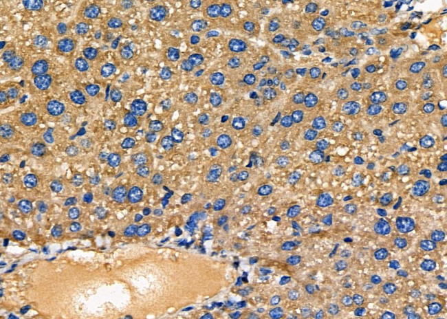 NDUFAF1 Antibody in Immunohistochemistry (Paraffin) (IHC (P))