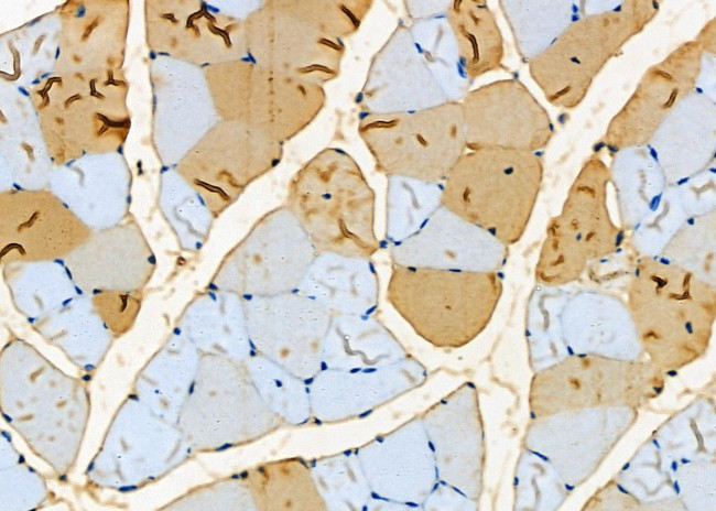 NDUFAF1 Antibody in Immunohistochemistry (Paraffin) (IHC (P))