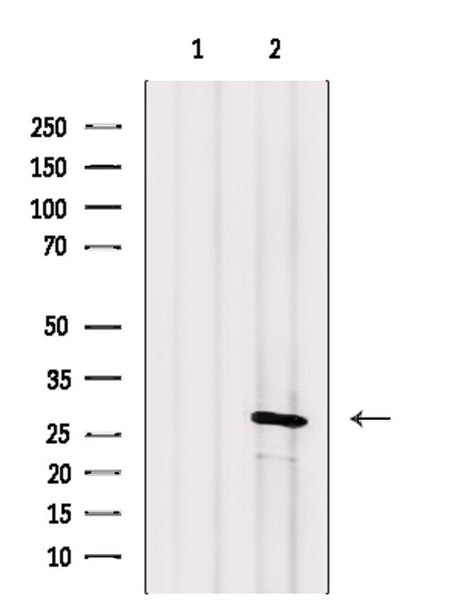 Calpain S1 Antibody in Western Blot (WB)