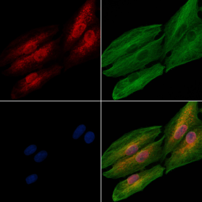 INPP4A Antibody in Immunocytochemistry (ICC/IF)