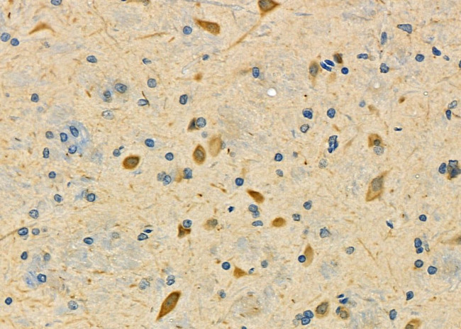 INPP4A Antibody in Immunohistochemistry (Paraffin) (IHC (P))