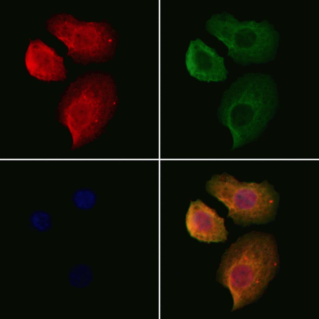 Hemoglobin Antibody in Immunocytochemistry (ICC/IF)