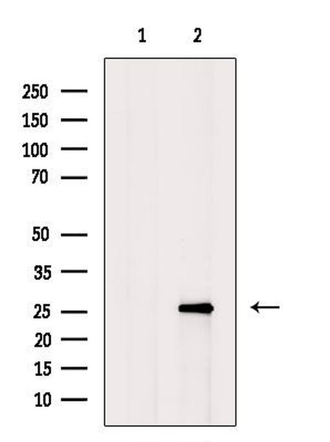 Hemoglobin Antibody in Western Blot (WB)