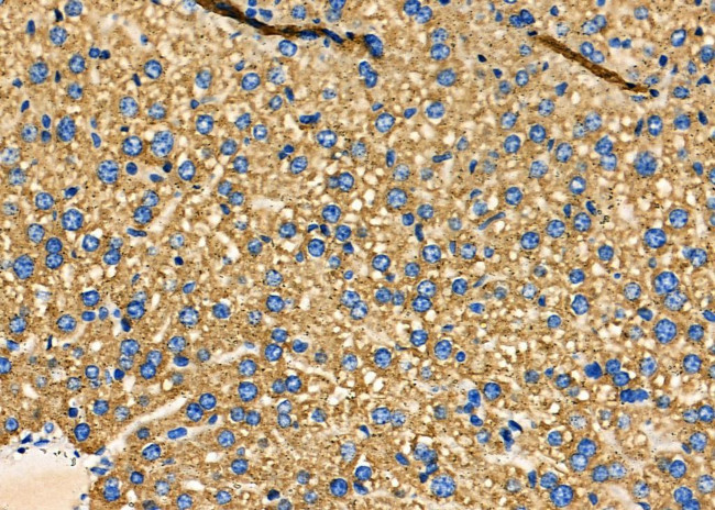 PUM1 Antibody in Immunohistochemistry (Paraffin) (IHC (P))