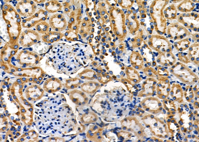 PUM1 Antibody in Immunohistochemistry (Paraffin) (IHC (P))