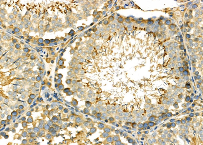 PUM1 Antibody in Immunohistochemistry (Paraffin) (IHC (P))