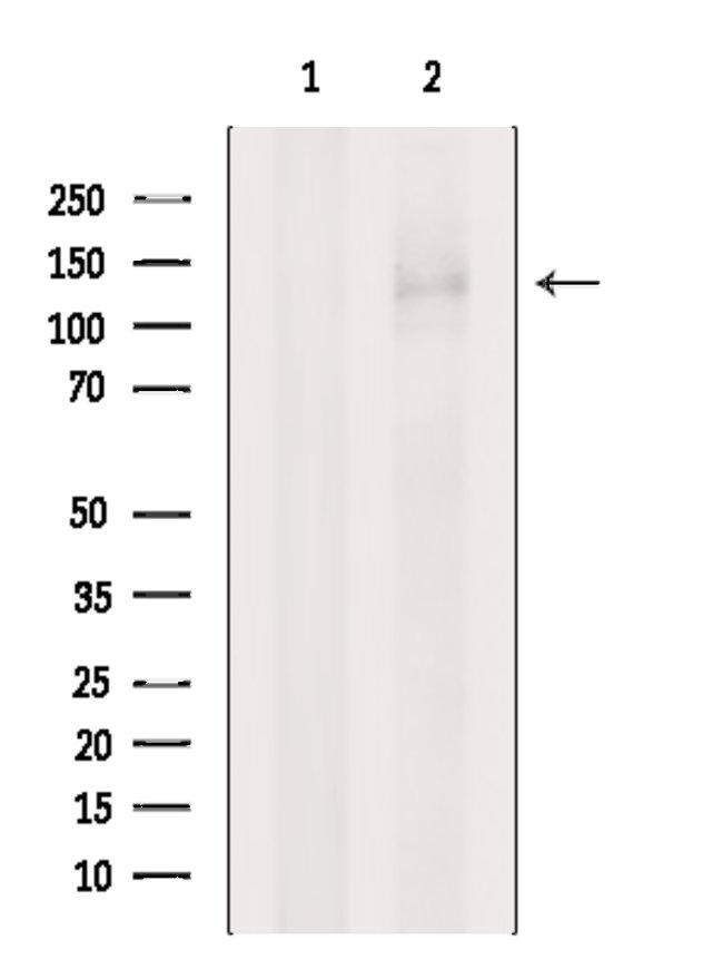 PUM1 Antibody in Western Blot (WB)