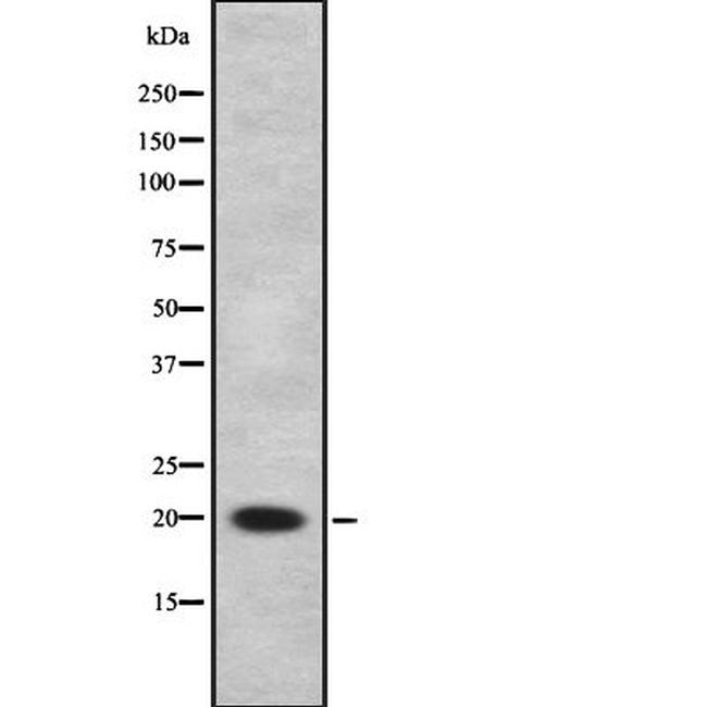 CITED1 Antibody in Western Blot (WB)