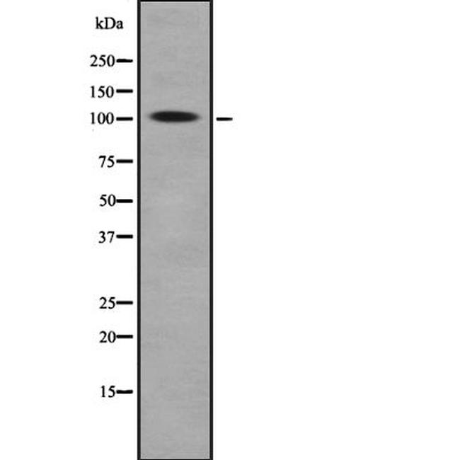 ROR2 Antibody in Western Blot (WB)