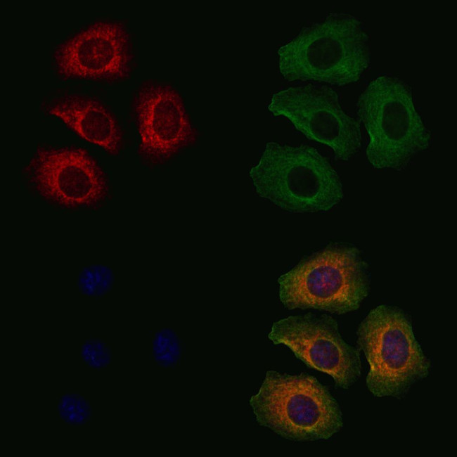 EYA2 Antibody in Immunocytochemistry (ICC/IF)