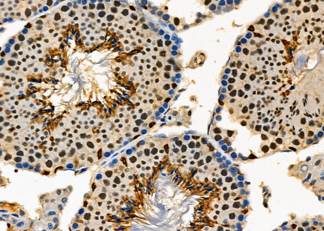 PCYT1A Antibody in Immunohistochemistry (Paraffin) (IHC (P))