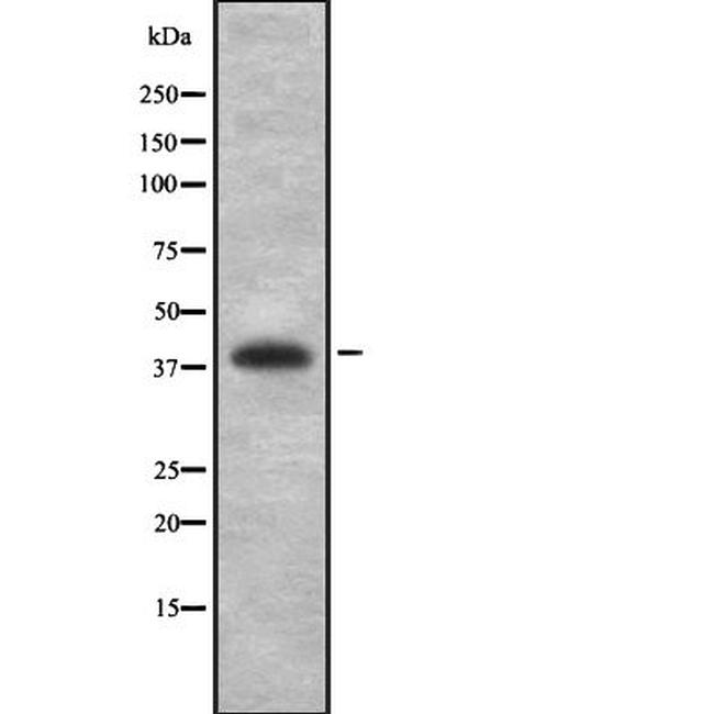 PCYT1A Antibody in Western Blot (WB)