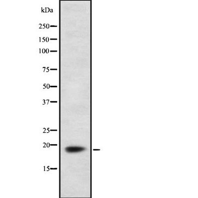 FDX1 Antibody in Western Blot (WB)