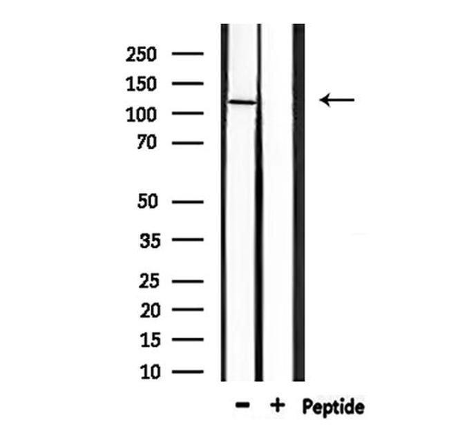 GluR4 Antibody in Western Blot (WB)