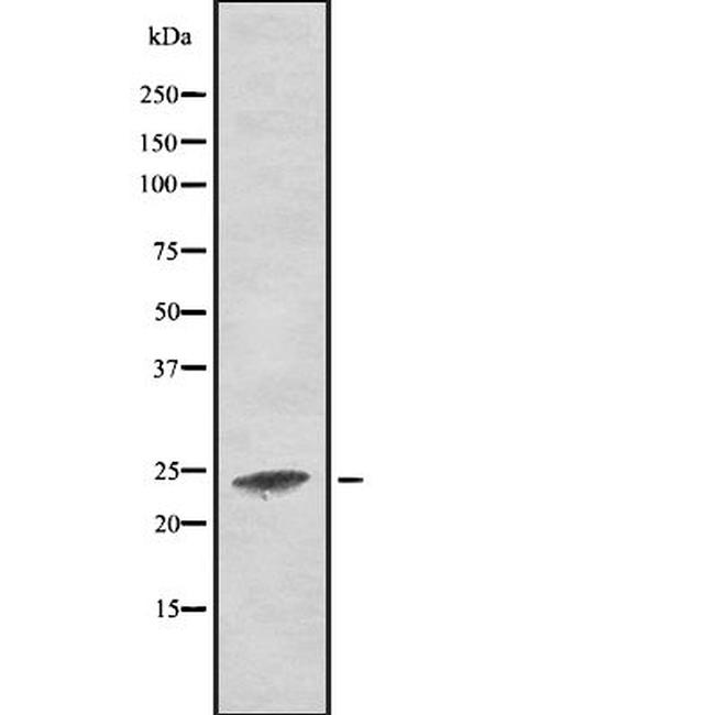 RALA Antibody in Western Blot (WB)