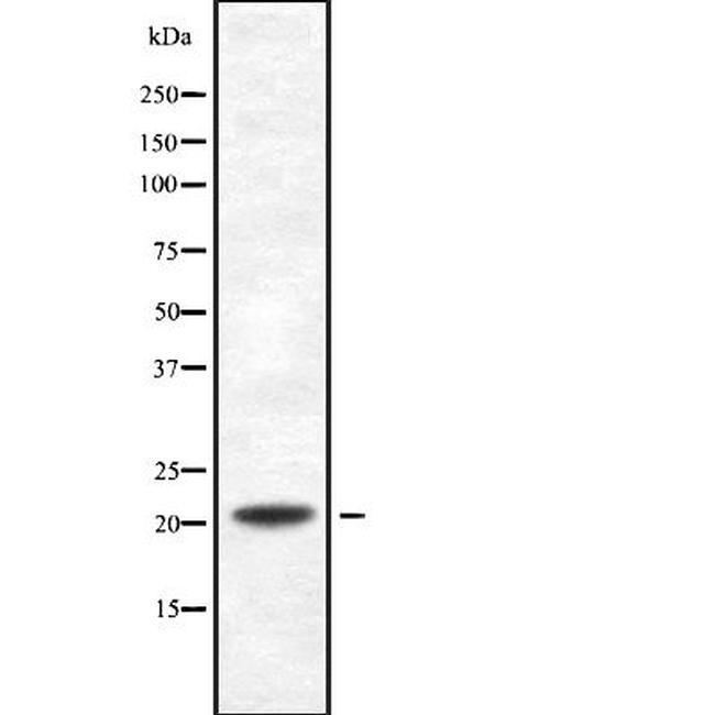 PDCD6 Antibody in Western Blot (WB)