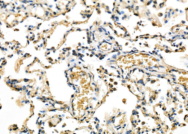 MAD3 Antibody in Immunohistochemistry (Paraffin) (IHC (P))