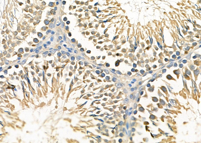 CAB39 Antibody in Immunohistochemistry (Paraffin) (IHC (P))