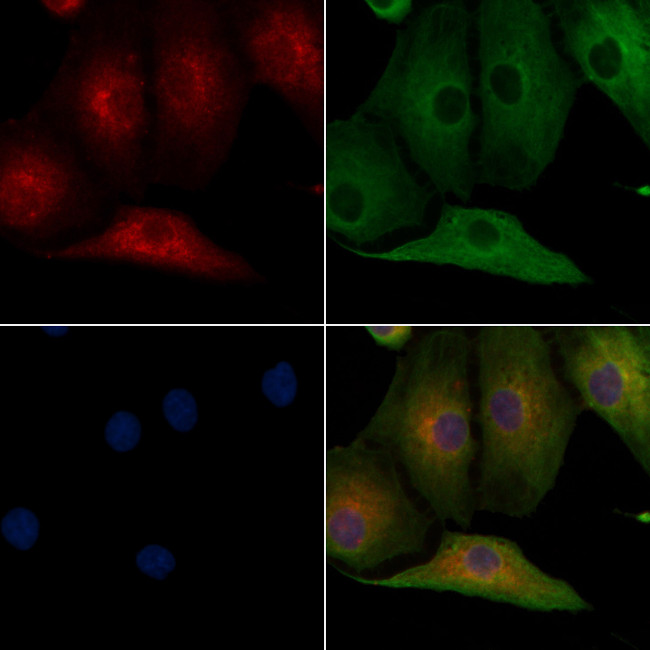 Calsequestrin 2 Antibody in Immunocytochemistry (ICC/IF)