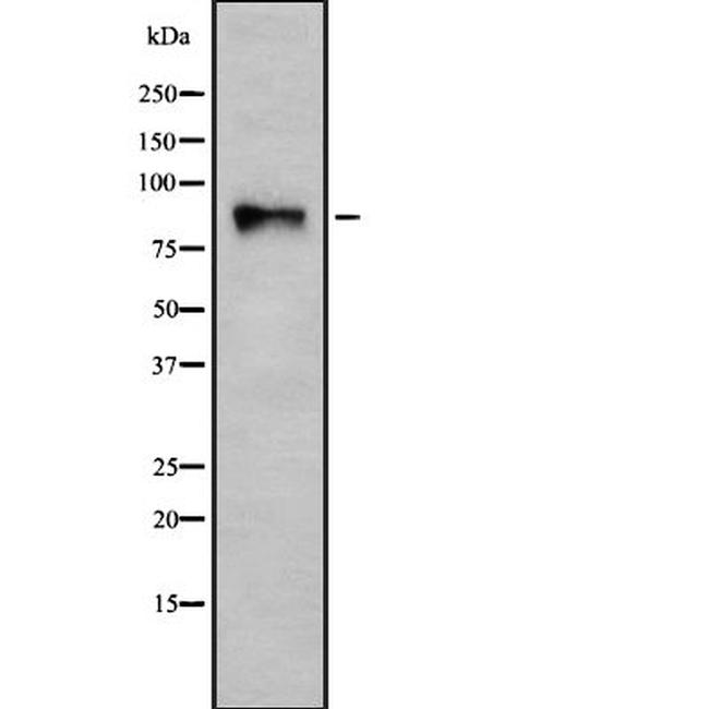 Integrin beta 7 Antibody in Western Blot (WB)